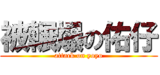 被輾爆の佑仔 (attack on yoyo)