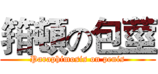 箝頓の包莖 (Paraphimosis on penis)