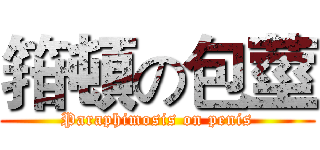 箝頓の包莖 (Paraphimosis on penis)