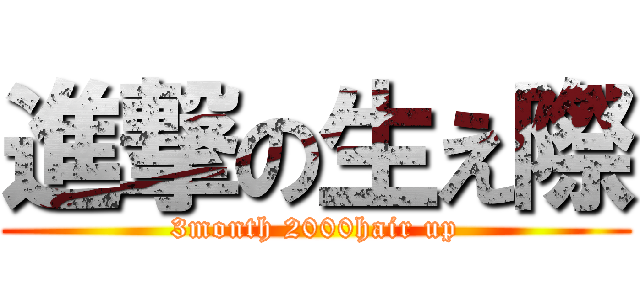 進撃の生え際 (3month 2000hair up)