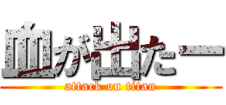 血が出たー (attack on titan)