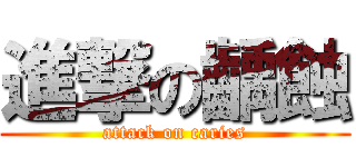 進撃の齲蝕 (attack on caries)