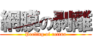 網膜の剥離 (Peeling of retina)
