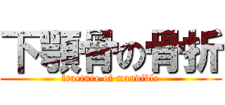 下顎骨の骨折 (fracture of mandible)