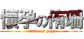 懷孕の侑珊 (attack on yoyo)