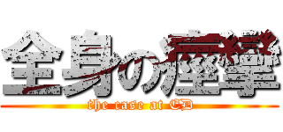 全身の痙攣 ( the case at ED)