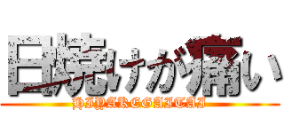 日焼けが痛い (HIYAKEGAITAI)