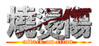 燒燙傷 (attack on titan)