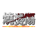 燒燙傷 (attack on titan)