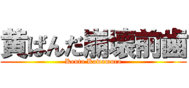 黄ばんだ崩壊前歯 (Kenta Kawamura)