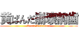 黄ばんだ崩壊前歯 (Kenta Kawamura)