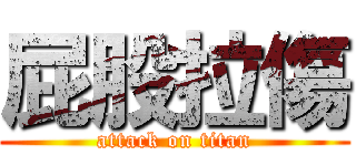 屁股拉傷 (attack on titan)