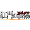 肛門の裂傷 (anal fissure)