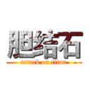 胆结石 (attack on titan)