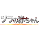 ヅラの赤ちゃん (wig baby)