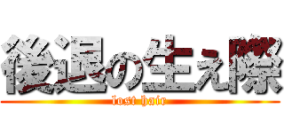 後退の生え際 (lost hair)