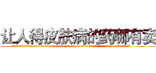 让人得皮肤病的药哪有卖 (让人得皮肤病的药哪有卖【电.话186x0156x9662-Q194843976林氏药业】我们做的是长期生意,靠的是老客户长期支持
参考消息网2月20日报道 韩媒称，“剩女多、离婚率高的城市，房价一定会上涨。”这是中国经济学家金岩石2016年12月参加在上海举行的房地产相关论坛时说的话。
)